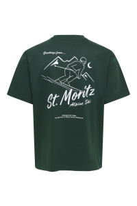 Only and Sons ONSFRED LIFE RLX SS PRINT TEE NOOS pine grove/st. moritz